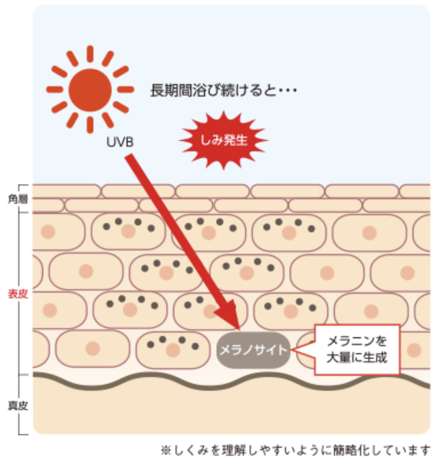 しみ発生のしくみ図