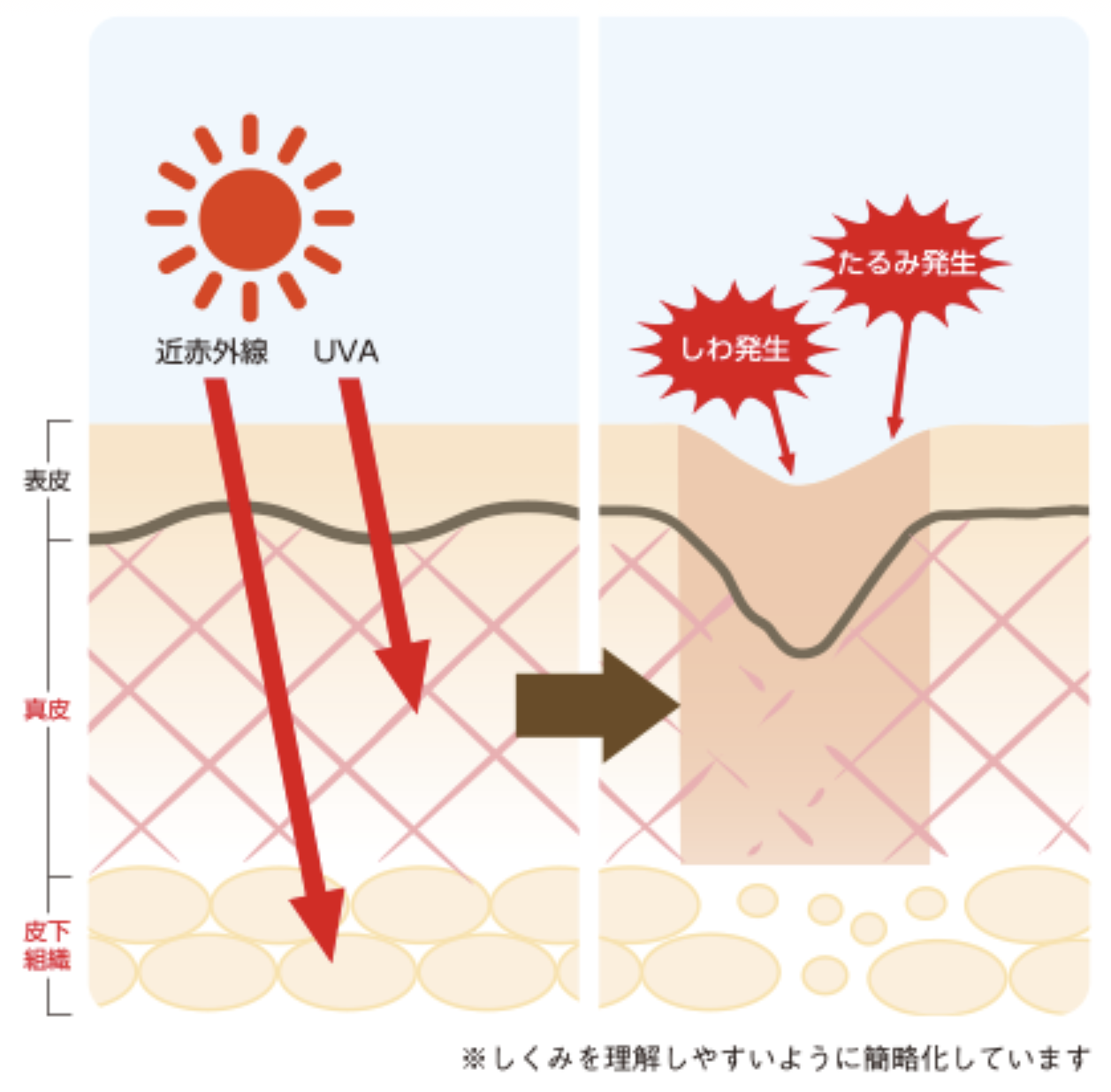 しわ、たるみ発生のしくみ